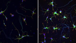 Supramolecular polymers can dramatically enhance brain cell activity