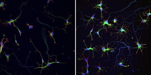 Supramolecular polymers can dramatically enhance brain cell activity